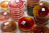 Stacks of petri dish faecal bacterial cultures