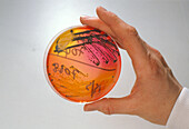 Hand holding a petri dish faecal bacterial culture