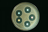 Anthrax antibiotics research
