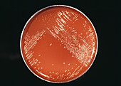 Cultured gonorrhoea bacteria