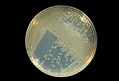 Cultured cholera bacteria