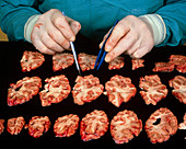 Brain slices undergoing gross pathology