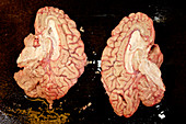 Human brain dissected in half
