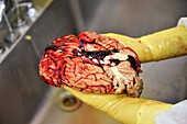 Brain,post-mortem