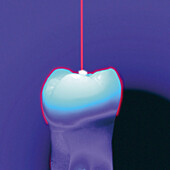 Computer graphic of a dental laser hitting a tooth