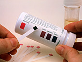 Doctor & positive (abnormal) Clinistix urine test