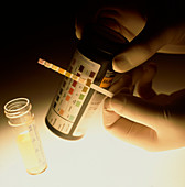 Gloved hand holding urine sample test stick