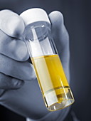 Urine sample