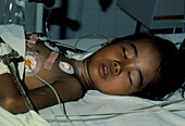 Boy with diphtheria in intensive care