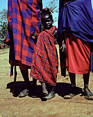 Burns patient,Kenya