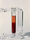 Centrifuged sample of sheep's blood