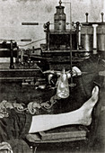 First photo of X-ray method to patient's leg,1896