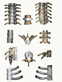 Spinal bones and ligaments