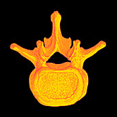 Spinal vertebra