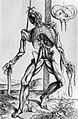 16th century illustration of a suspended corpse