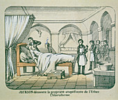 Illustration of Jackson using ether as anaesthetic