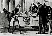 19th century surgery using antiseptic spray