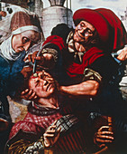 Artwork of a surgeon operating on a person's head