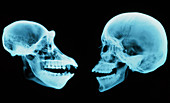 Coloured X-ray of human and chimpanzee sk