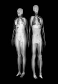 Human skeletons X-ray