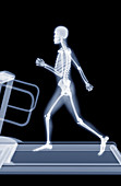 Jogging on a treadmill,X-ray artwork