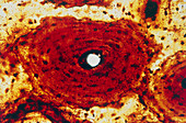 Light micrograph of human bone