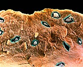 SEM of osteoblast cells in a bone matrix