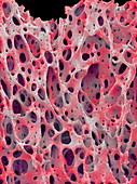 Bone tissue