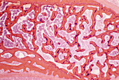 Cancellous bone,light micrograph