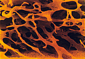 Spongy bone tissue,coloured SEM