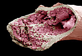Interior of a bone,SEM
