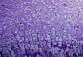 Bone formation: LM of epiphyseal growth plate