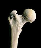 The head of the human femur