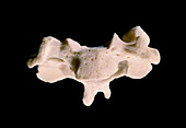 Fourth cervical vertebra of the neck