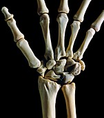 Bones of the wrist joint