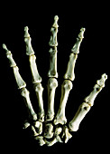 Photo of skeleton of human right wrist and hand