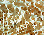Interior of human bone