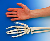 Human hand lying beside skeleton