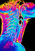 Coloured X-ray of a normal neck in profile