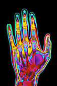 Coloured X-ray of the healthy hand of a man