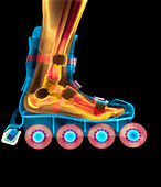 Coloured X-ray of a foot in a roller blade
