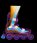 Foot in roller blade,X-ray