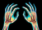 Coloured X-ray of healthy human hands