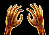 Coloured X-ray of healthy human hands
