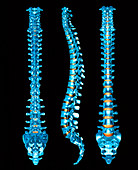Human spine,three views