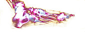 Foot bones,X-ray