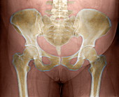 Female pelvis,X-ray