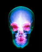 Coloured X-ray of the human skull