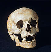 Skull of modern human
