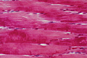 Light micrograph of normal smooth muscle